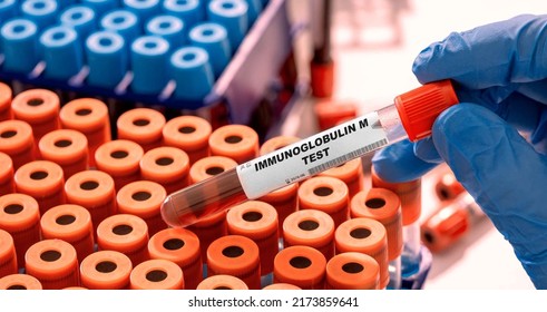 Immunoglobulin M Test Tube With Blood Sample In Infection Lab