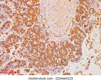 Immunohistochemistry Staining Is Used In Histopathology To Do Research Or Diagnosis.