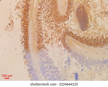 Immunohistochemistry Staining Is Used In Histopathology To Do Research Or Diagnosis.