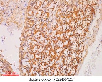 Immunohistochemistry Staining Is Used In Histopathology To Do Research Or Diagnosis.