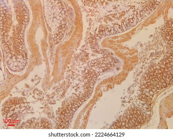 Immunohistochemistry Staining Is Used In Histopathology To Do Research Or Diagnosis.