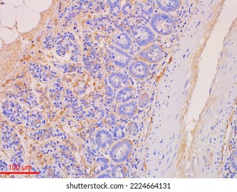 Immunohistochemistry Staining Is Used In Histopathology To Do Research Or Diagnosis.