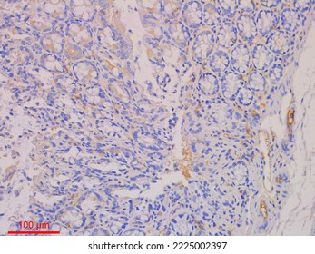 Immunohistochemistry Staining Is Used In Histopathology To Do Research Or Diagnosis.