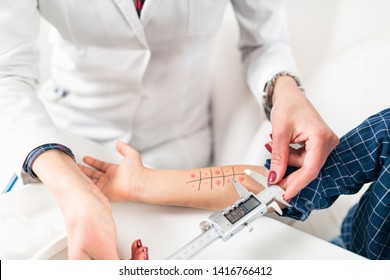 Immunology Doctor Measuring Allergy Reaction Of Patient, Little Boy