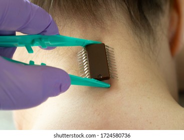 Implantation Of Chip Under The Human Skin. Microchip Is Connected To The Female Body. Concept Of Future Technologies Aimed At Tracking And Identifying People. Selective Focus