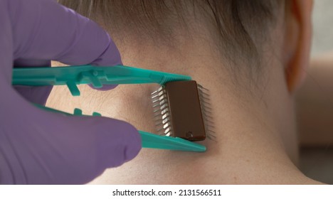 Implantation Of A Microchip Under Human Skin. Selective Focus. Human Mind Control Using Computer Technology. Identifying People. 