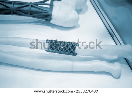 Implants and prostheses printed on 3D printer from biocompatible titanium powder. Titanium implant replacement of tubular bones on white human bone printed on 3D printer. Endoprostheses Bioengineering