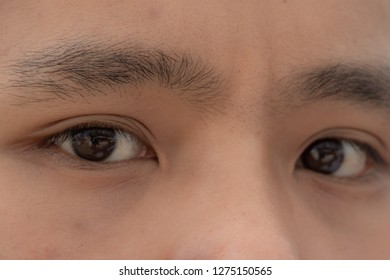 Implied two eyes