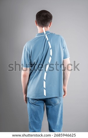 Incorrect posture, man with severe spinal curvature on gray studio background, healthcare and medicine concept