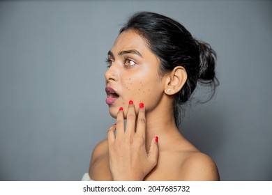 Indian Beautiful Young Woman Worrying Side Face About Her Pimples, Acne And Dark Spots On Skin. Beauty And Skincare Concept Isolated On Gray Background