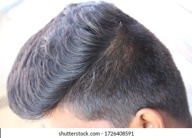 頭皮 の画像 写真素材 ベクター画像 Shutterstock