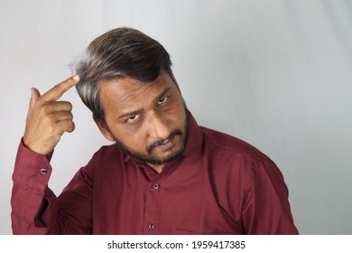 An Indian Man Showing His White Hair And Hair Loss Problem At A Young Age