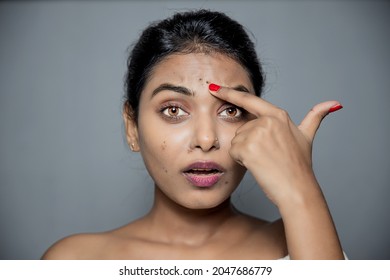 Indian Woman Pointing On Head Face Pimple, Dark Sport. Sad Face 
Caused By Hormonal Imbalance Changes, Stress Or Diet.
Skin Care Concept Isolated On Gray Background