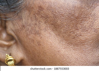 Indian women skin texture close up