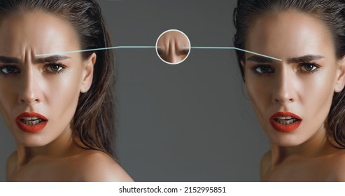 indignant and surprised glamor brunette woman with a wrinkle on her forehead, dissatisfied with aging and the appearance of wrinkles on her skin. Collage before and after botulinum toxin injection