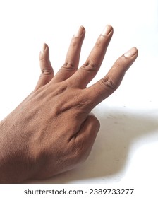 Indonesian man's left hand with mallet finger. On a white background.