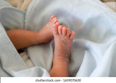 Infant Baby Feet Having Flaky Skin. Newborn Boy At Hospital With Very Dry Skin After Born. Asian-German. Soft Selective Focus