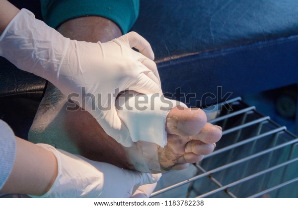 Infected Woundpatient Man Foot Stock Photo Edit Now 1183782238   Infected Woundpatient Man Foot 600w 1183782238 