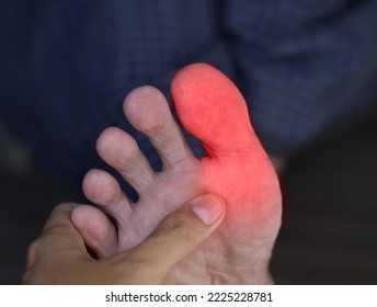 Inflammation in the big toe of Asian man. Concept of foot joint pain, arthritis, stumble, hyperuricema or gout.