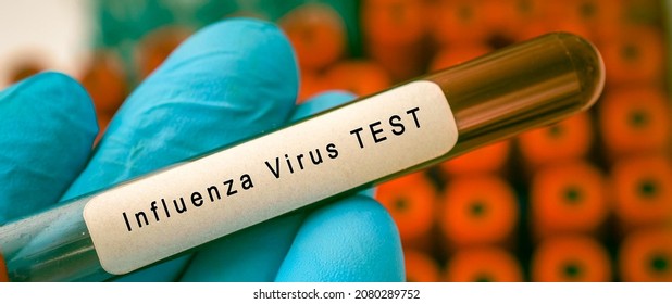 Influenza Virus Test Result With Blood Sample In Test Tube On Doctor Hand In Medical Lab