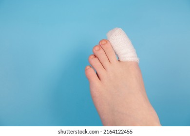 ingrown toenail healing by removed some nail by doctor. Bandaged toe. Close up photo of bandaged injured toenail isolated on blue background. Medical problem with toe. injured toenail in clinic - Shutterstock ID 2164122455