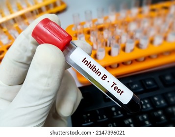 Inhibin B Hormone Test Major Marker Stock Photo 2147396021 | Shutterstock