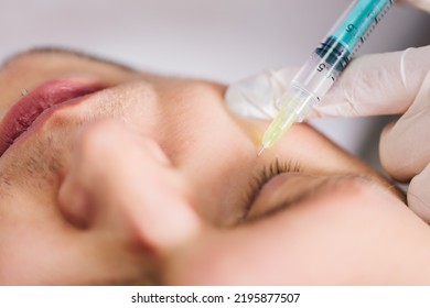 Injectable Tissue Stimulator On Man Face In Beauty Salon. Aesthetic Medicine