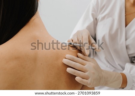 Injection in marked dotes on back for migraine treatment by doctor. Preparation skin marking for migraine therapy. Remedy of headache problem and pain problems