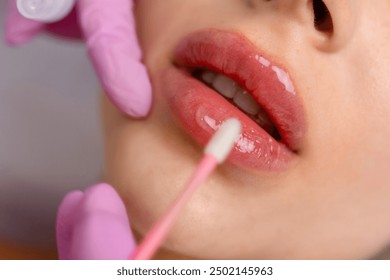 Injection procedure for lip augmentation, close-up. The cosmetologist slowly and carefully injects filler into the client lips. Advertising concept for facial care, youth and beauty - Powered by Shutterstock