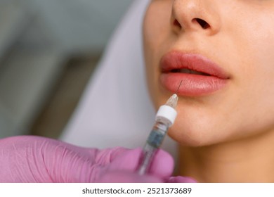 Injection procedure for lip augmentation, close-up. The cosmetologist slowly and carefully injects filler into the client lips. Advertising concept for facial care, youth and beauty