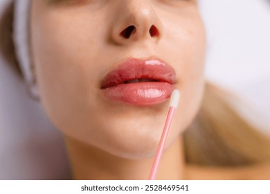 Injection procedure for lip augmentation, close-up. The cosmetologist slowly and carefully injects filler into the client lips. Advertising concept for facial care, youth and beauty - Powered by Shutterstock