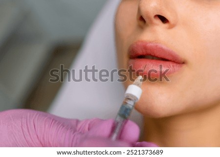 Injection procedure for lip augmentation, close-up. The cosmetologist slowly and carefully injects filler into the client lips. Advertising concept for facial care, youth and beauty