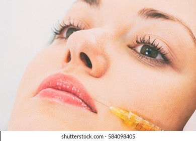 Injections in the face