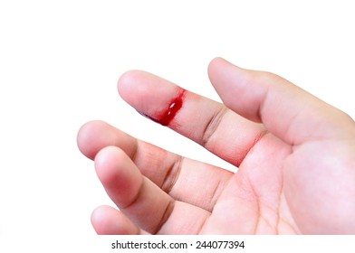 Hand Bleeding Images Stock Photos Vectors Shutterstock