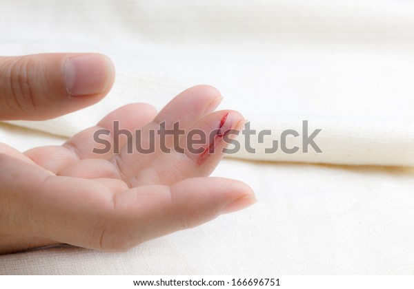 Injured Finger Bleeding Open Cut Stock Photo (Edit Now ...