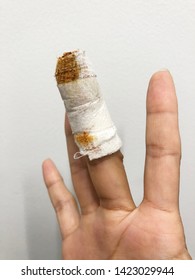 Injured Finger With Bloody Gauze Bandage.