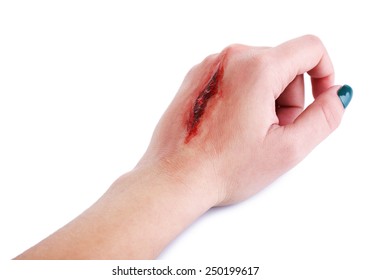 Hand Cut Blood Images, Stock Photos & Vectors | Shutterstock