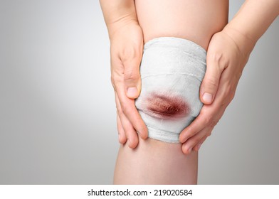 Injured Knee With Bloody Gauze Bandage