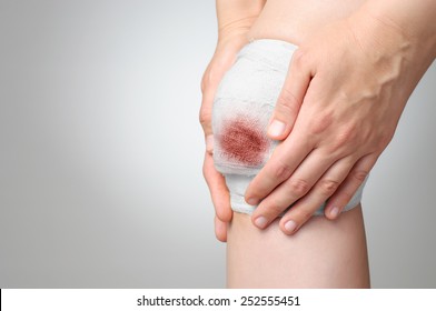 Injured Knee With White Bloody Gauze Bandage