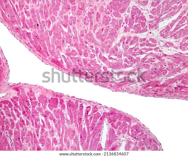 Inner surface of a human heart atrium showing the\
myocardium covered by the endocardium. It is the innermost layer of\
the heart wall, lined by an endothelium supported on a connective\
tissue layer.