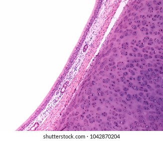 Inner Surface Of Trachea Showing The Mucosa Lined By Ciliated Pseudostratified Columnar Epithelium (respiratory Epithelium), The Lamina Propria With Smooth Muscle Fibers, And The Tracheal Cartilage.