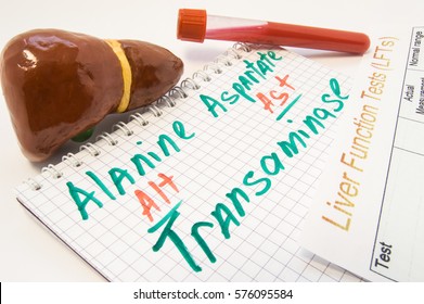 Inscribed Alanine (ALT) And Aspartate (AST) Aminotransferases, Surrounded By Liver, Laboratory Test Tubes With Blood And Result Of Liver Functional Analysis. Hepatic Transaminase Levels And Functions