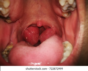 Inside View Of A Mouth