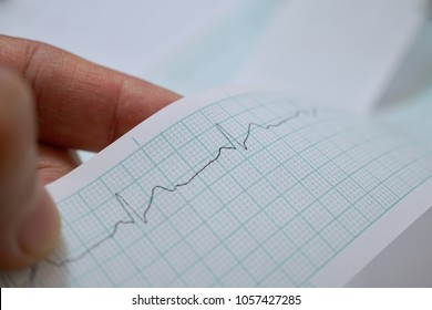 Inspection ECG Wave From ECG Recorder Paper.