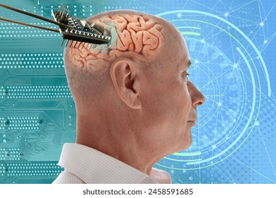 Installing electronic chip into human brain, applied in various fields neurotechnology and medical science, cutting-edge technology, restore sight