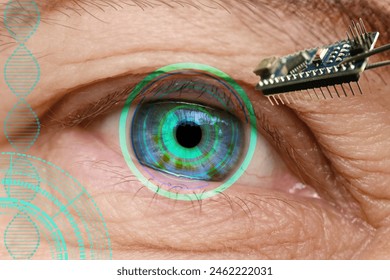 Installing electronic chip into human bionic, neuroprosthetic eye, cutting-edge technology, Visionary technological advancement and futuristic vision