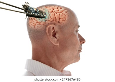 Installing electronic chip into human brain, applied in various fields neurotechnology and medical science, computer control person