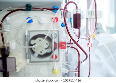 intensive care emergency room with hemodialysis machine or hemofiltration procedure