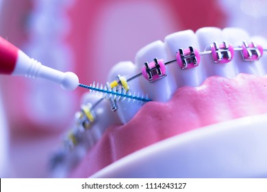 Inter dental teeth cleaning brush healthy floss action between each tooth with braces aligners.