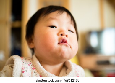 An Interesting Face Overlooking The Bossy From Above The Diagonal / A Japanese Baby Of 11 Months Of Age